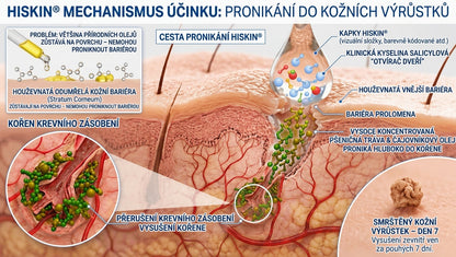 𝐇𝐢𝐬𝐤𝐢𝐧® 2-in-1 Pokročilý bezbolestný krém pro péči o pokožku bez viditelných stop – pro kožní výrůstky, bradavice a viditelné nedokonalosti pokožky
