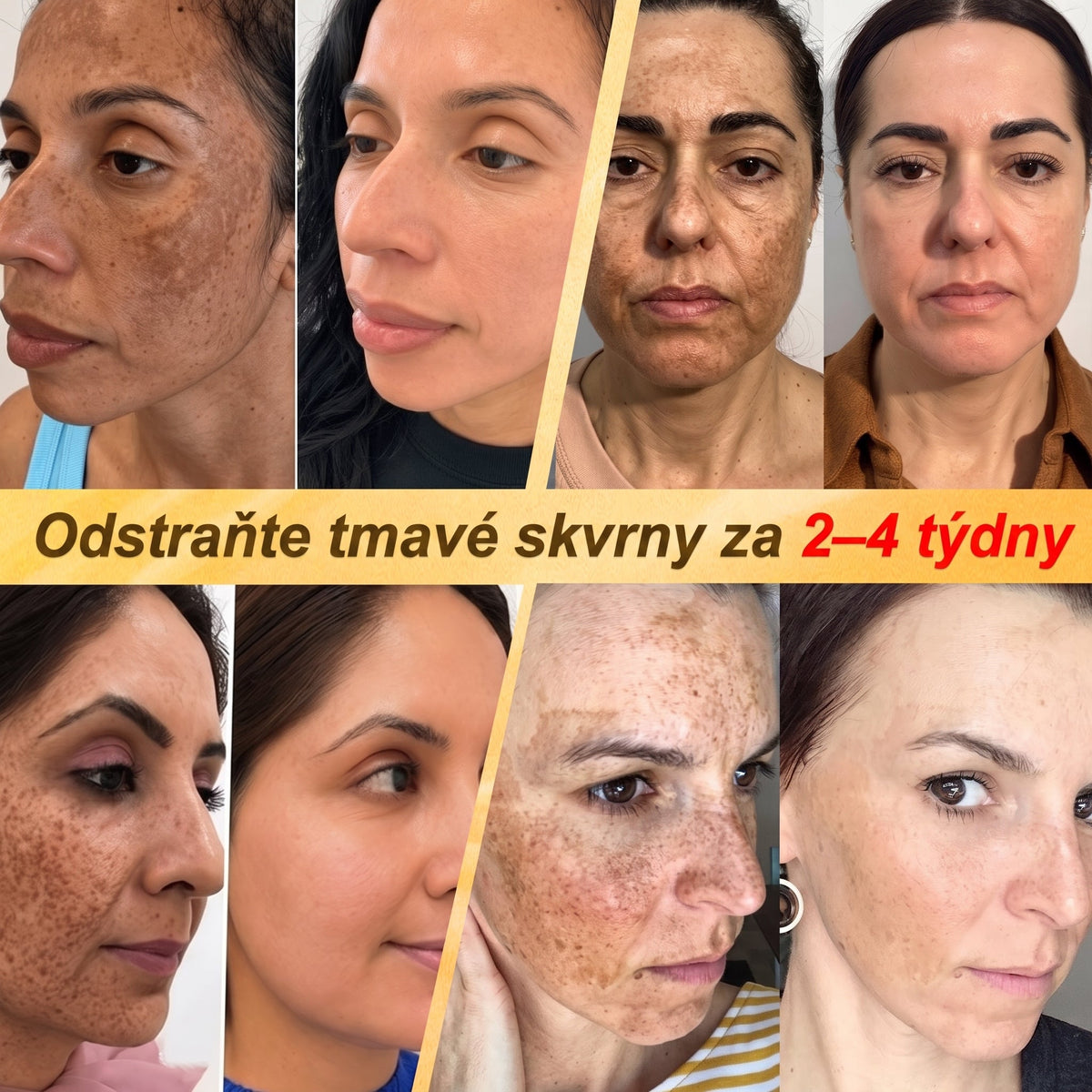 HISKIN® Multi-Concern Skin Repair Cream ✨ (One powerful cream to repair inflammation, dryness, aging, pigmentation, and visible skin damage.)