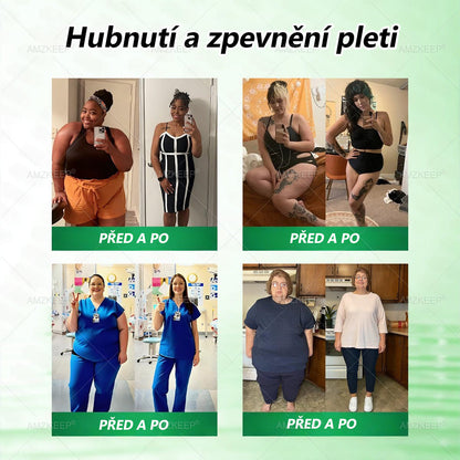 🇨🇿 🔥 50% SLEVA | Lékařsky vyvinutá AMZKEEP® náplast Moringa Berberin × NAD+ 10 v 1 | Pokročilá nano-mikrojehlová technologie | Viditelné výsledky již za 7 dní