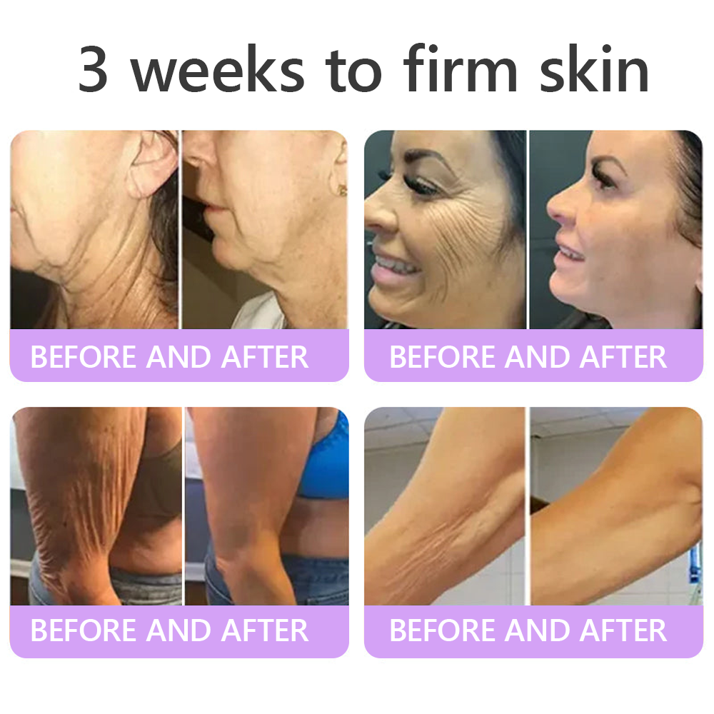 80% OFF HISKIN® PDRN Multi-Peptide Body Roller Cream – Firming, Hydrating, Anti-Aging & Skin Tone Care