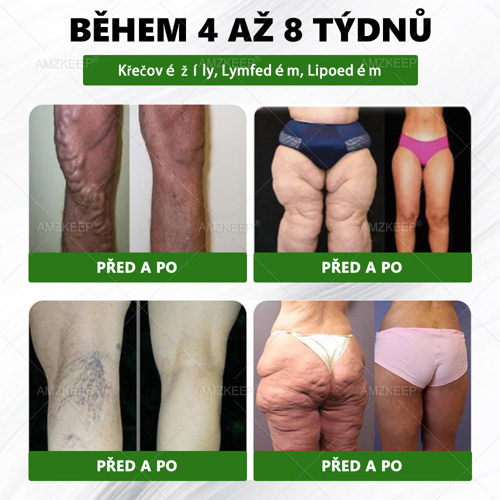 🇨🇿 🔥 50% SLEVA | Lékařsky vyvinutá AMZKEEP® náplast Moringa Berberin × NAD+ 10 v 1 | Pokročilá nano-mikrojehlová technologie | Viditelné výsledky již za 7 dní