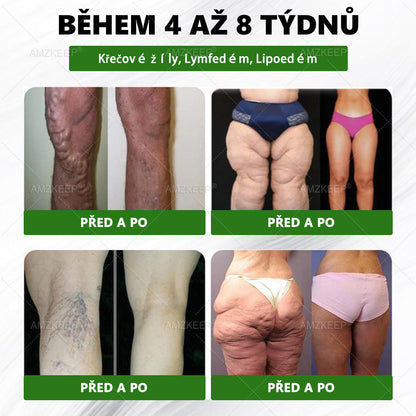 🇨🇿 🔥 50% SLEVA | Lékařsky vyvinutá AMZKEEP® náplast Moringa Berberin × NAD+ 10 v 1 | Pokročilá nano-mikrojehlová technologie | Viditelné výsledky již za 7 dní