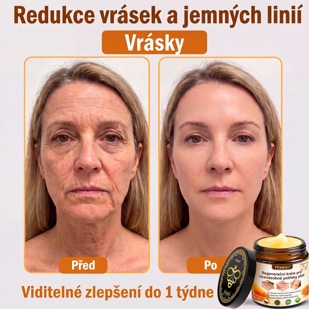 HISKIN® Multi-Concern Skin Repair Cream ✨ (One powerful cream to repair inflammation, dryness, aging, pigmentation, and visible skin damage.)